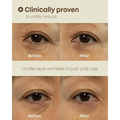 NINELESS Ever-Youth Dual Effect Eye Cream
